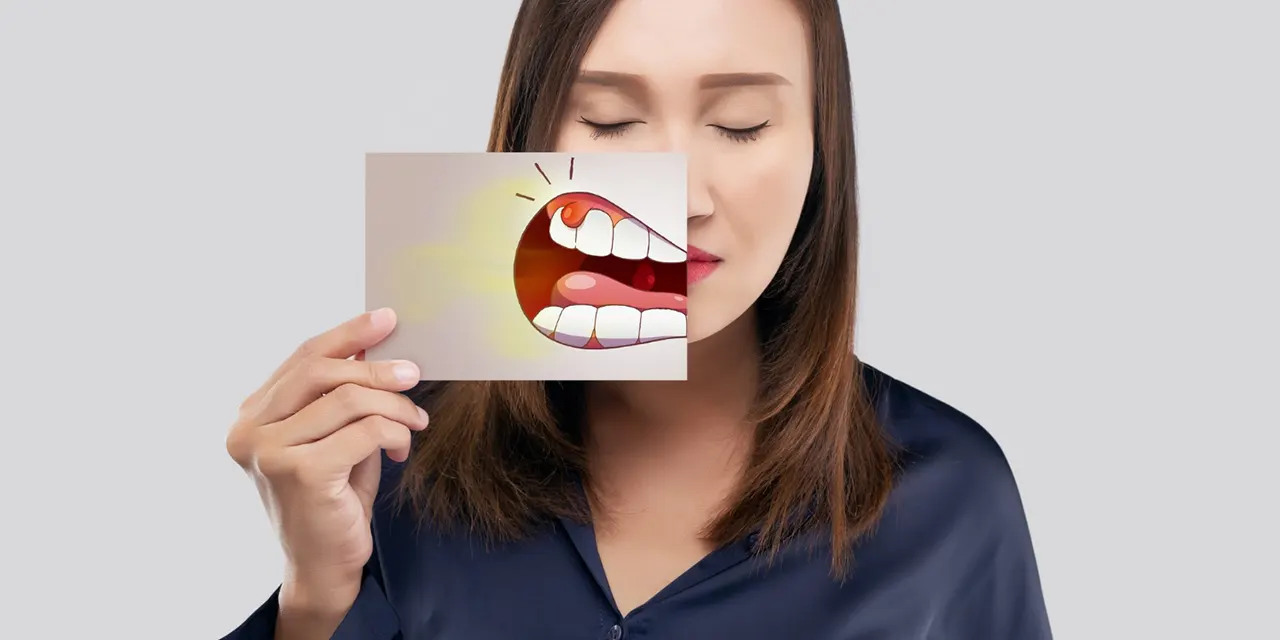 qué es la periodoncia qué es la periodoncia